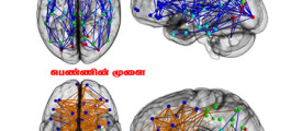 men-and-womens-brains