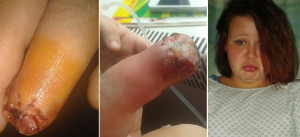 False-nail-glue-rotted