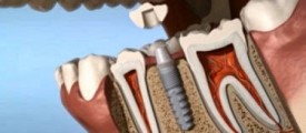 dental_app_001