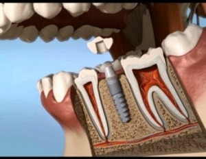 dental_app_001