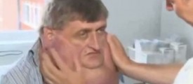 tumour-surge