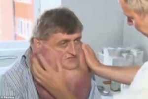 tumour-surge