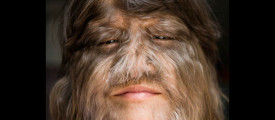 hairiest-girl224-600