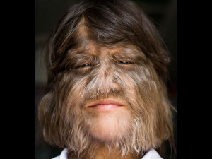 hairiest-girl224-600