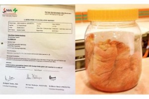 doctors-gauze-stomach