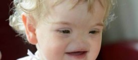 girl-baby-without-nose