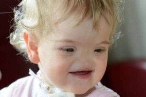 girl-baby-without-nose