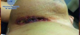 woman-smuggles-cocaine-in-her-breasts