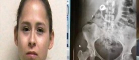 utah-woman-swallows-ring