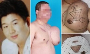 chinese-man-grows-second-face